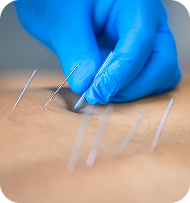 needles